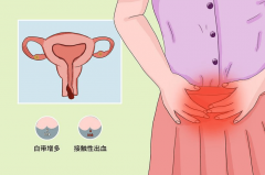 阴道的异常出血是哪些疾病引起的？