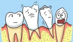 口腔疾病中的牙周炎是导致我国成年人牙齿丧失的首要因素