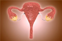 多囊卵巢，如何才能尽快怀孕？